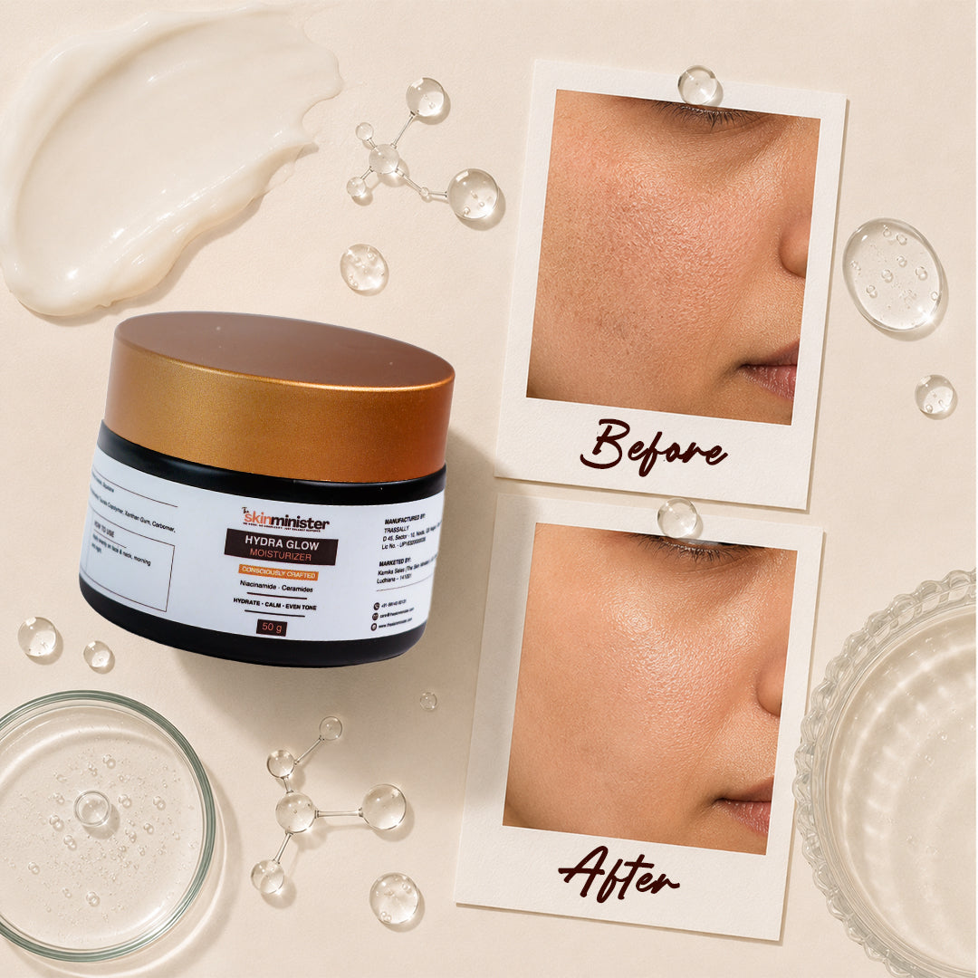 Moisturizer (50 g)